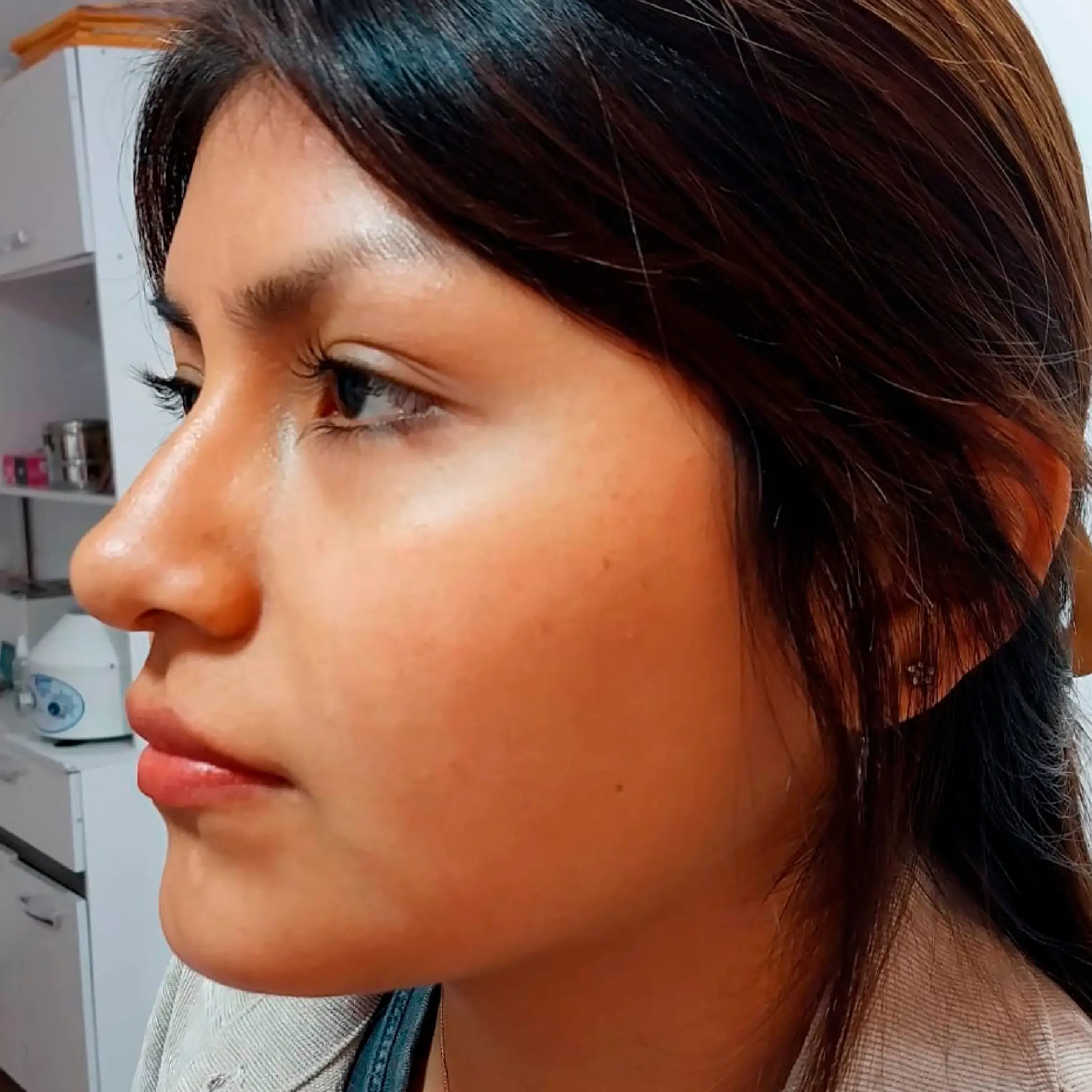 Antes - Proyecto 1